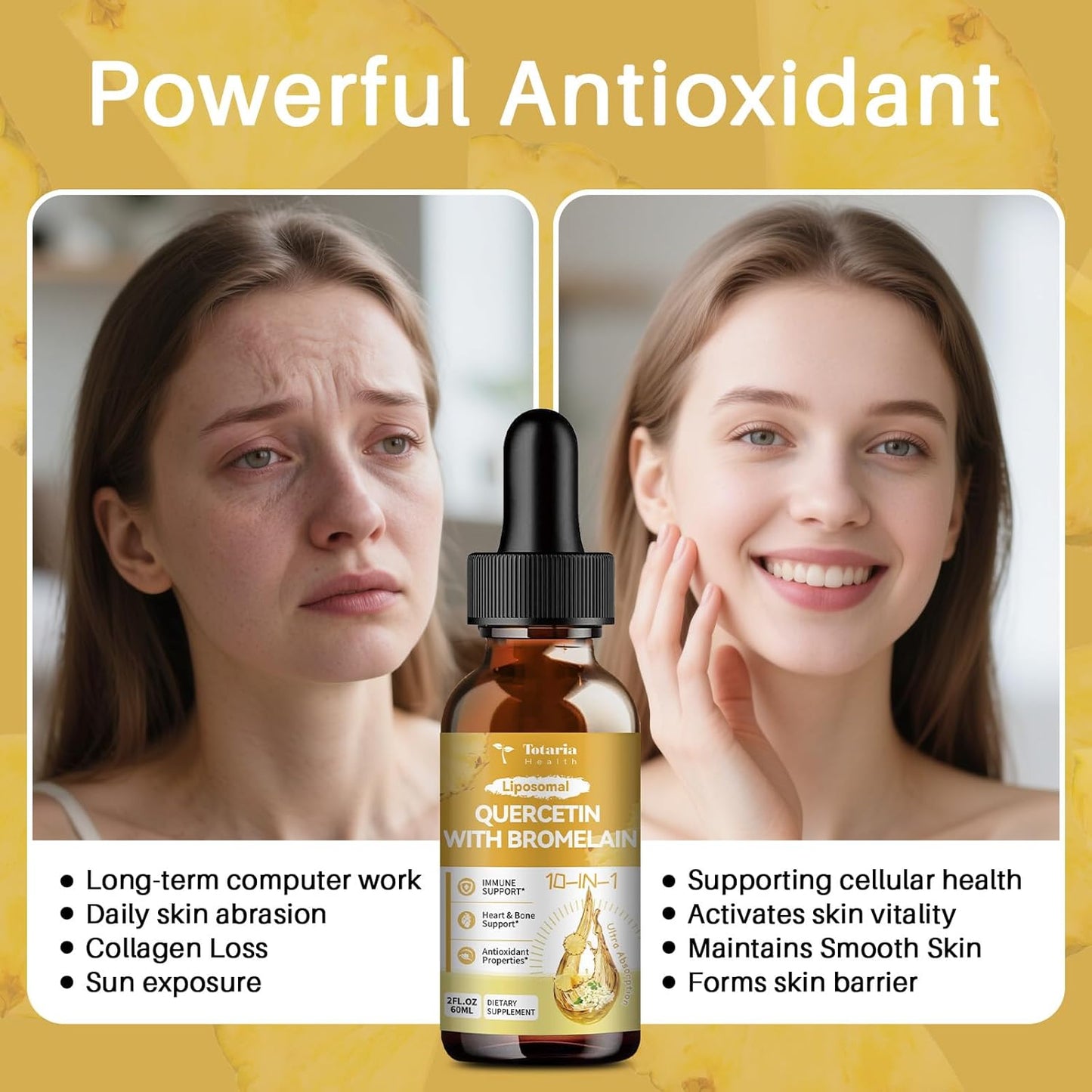 Liposomal Quercetin 1000mg with Bromelain & Elderberry Drops